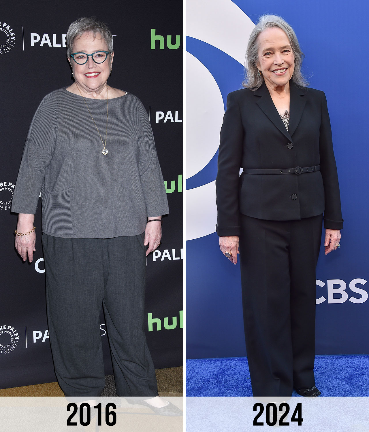 Kathy Bates weight loss transformation before and after 2016 vs 2024