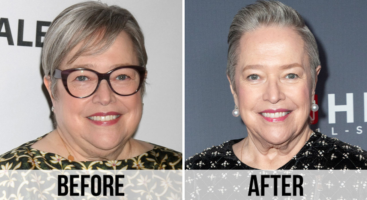 Kathy Bates weight loss transformation before and after