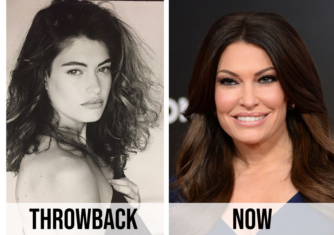 kimberly guilfoyle before and after