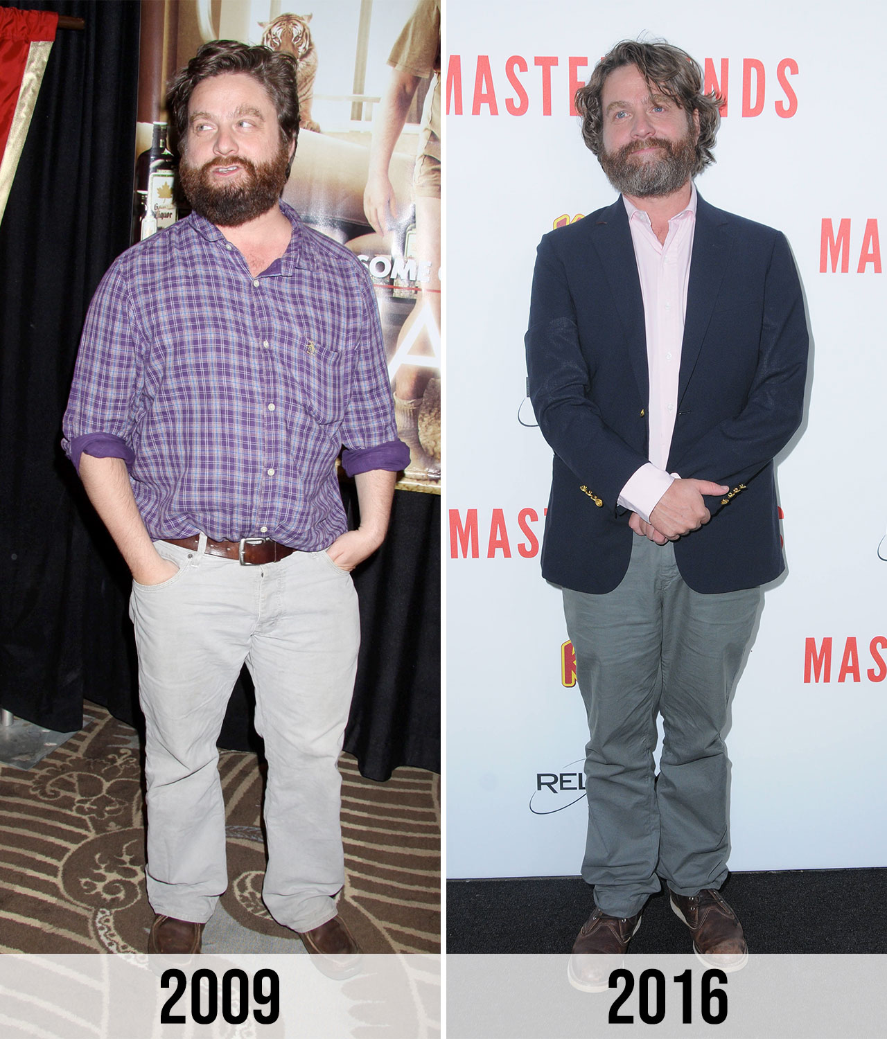 Zach Galifianakis before and after weight loss 2009 vs 2016