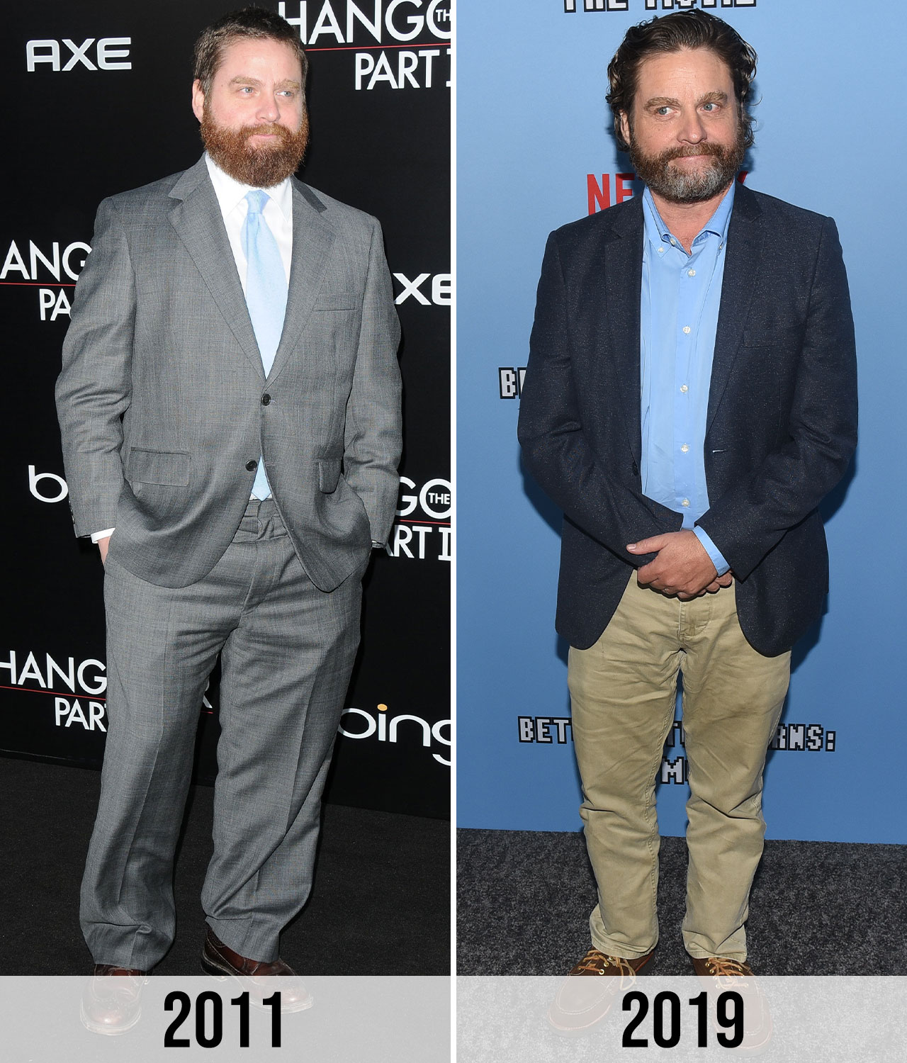 Zach Galifianakis before and after weight loss 2011 vs 2019