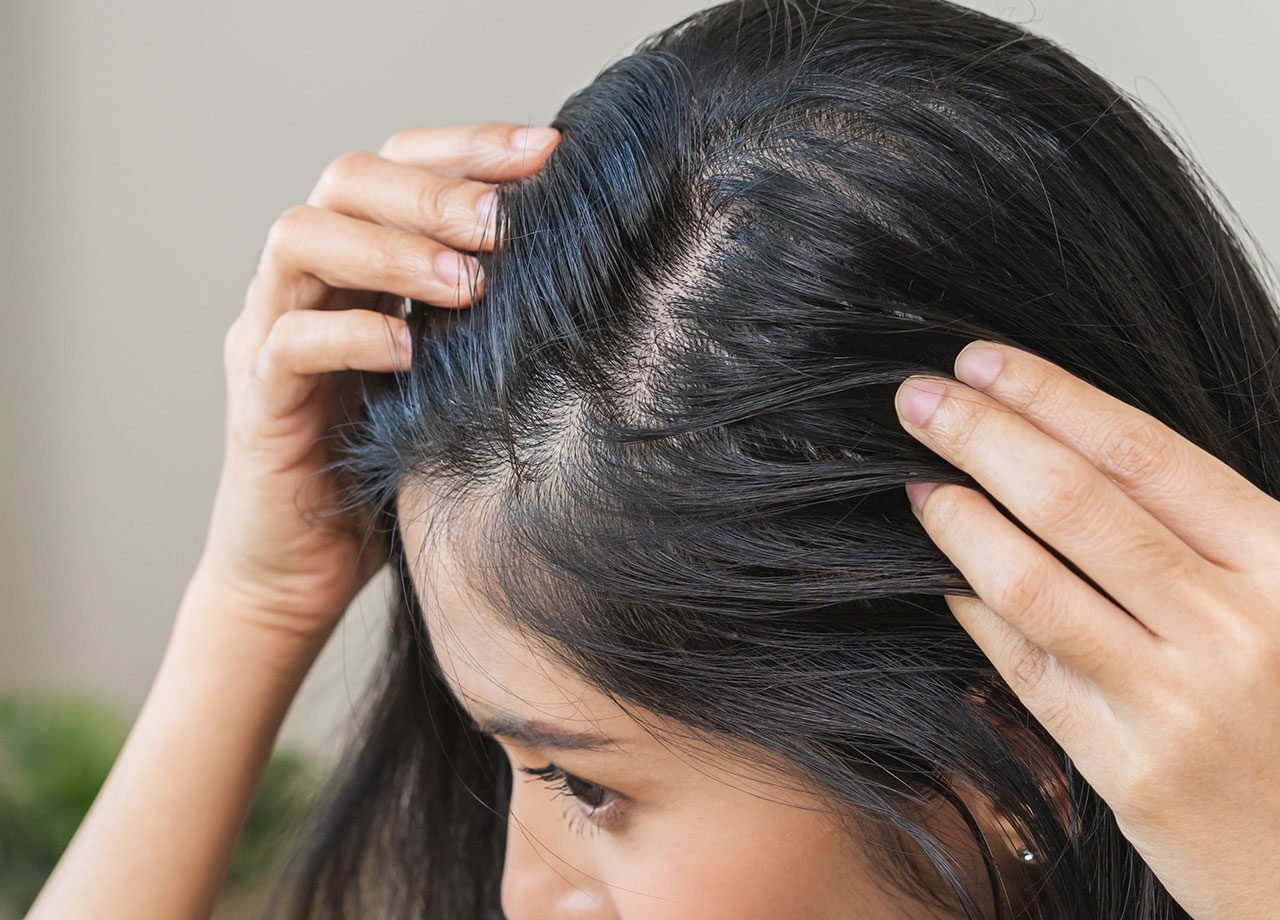 woman-checking-scalp-for-damage