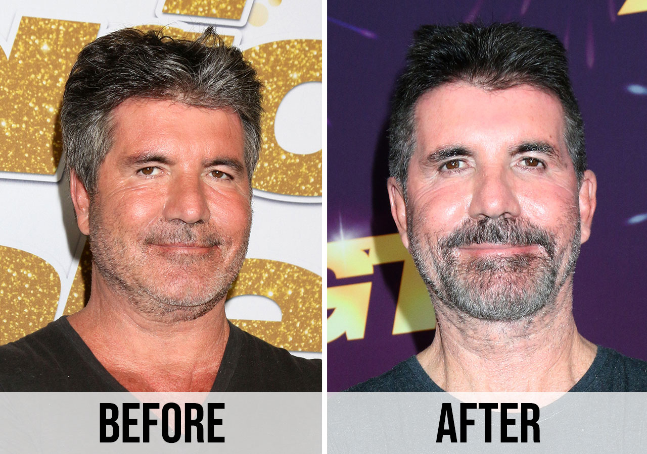 Simon Cowell weight loss before and after face