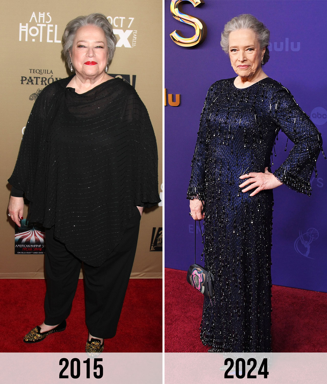 Kathy Bates weight loss 2016 vs 2024