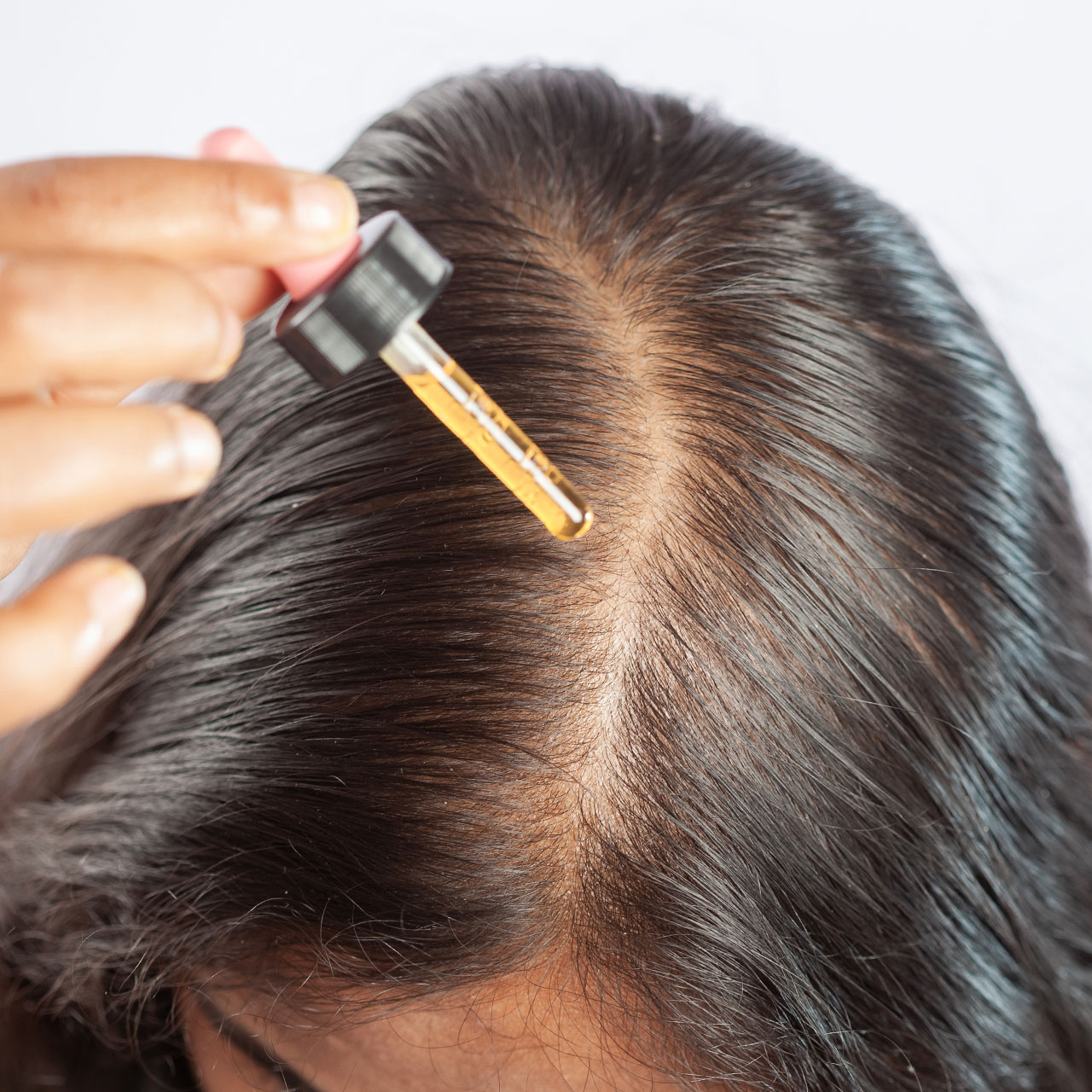 thinning scalp