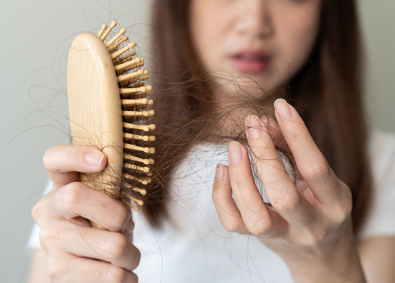 woman-hair-loss-brush