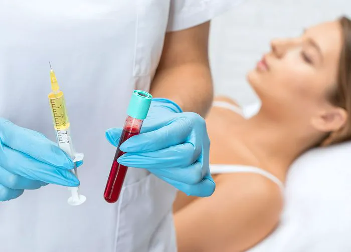 prp-treatment