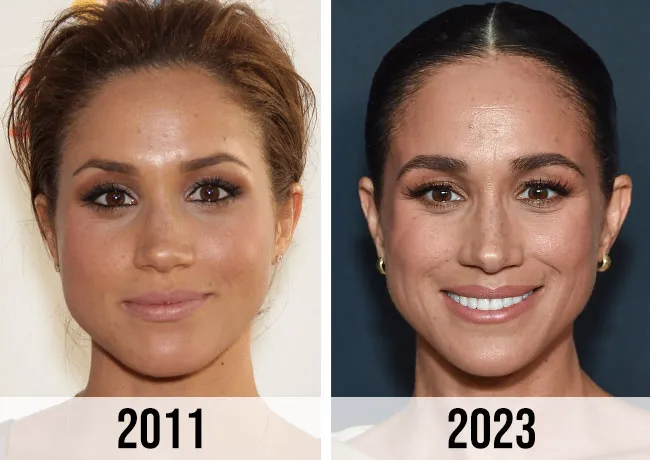 "Meghan Markle before and after face comparison 2011-2023"