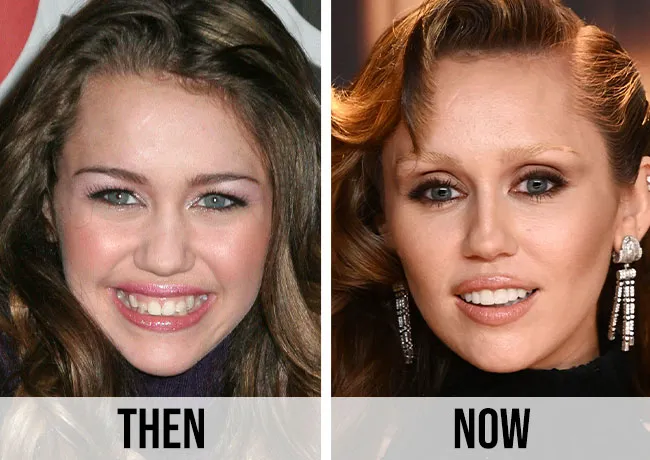 Miley Cyrus before and after