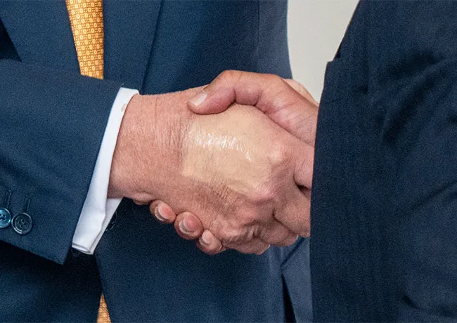 Donald Trump makeup on hands to cover bruise
