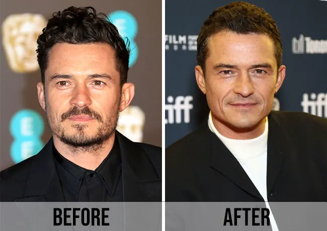 Orlando Bloom before and after The Cut