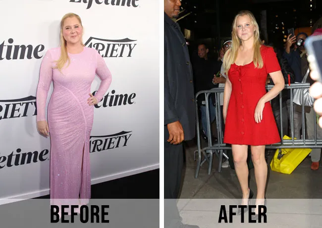 Amy Schumer weight loss before and after