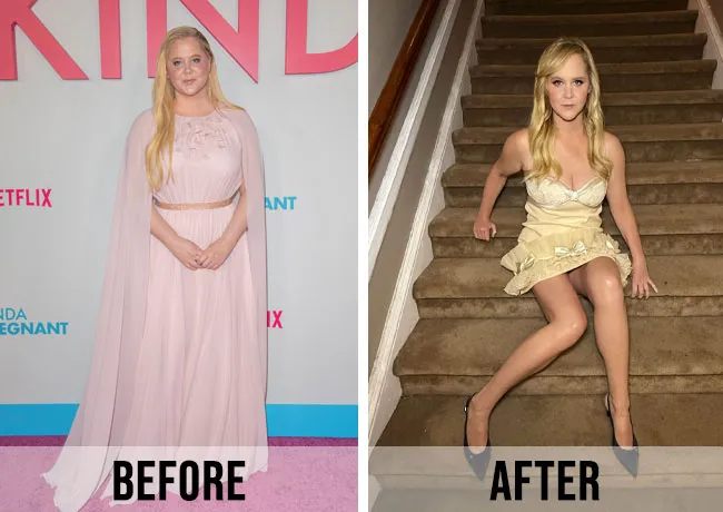 amy schumer weight loss