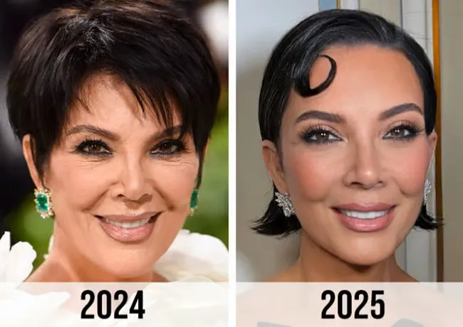 Kris Jenner before and after facelift 2024 vs 2025
