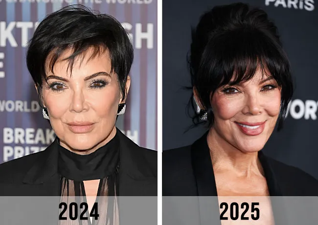 Kris Jenner before and after facelift 2024 vs 2025