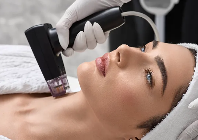 microneedling