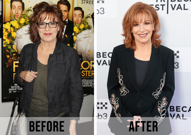 Joy Behar before and after