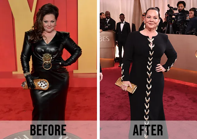 Melissa McCarthy weight loss before and after