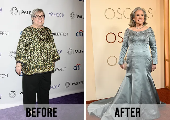 Kathy Bates before and after weight loss 2015 vs 2026