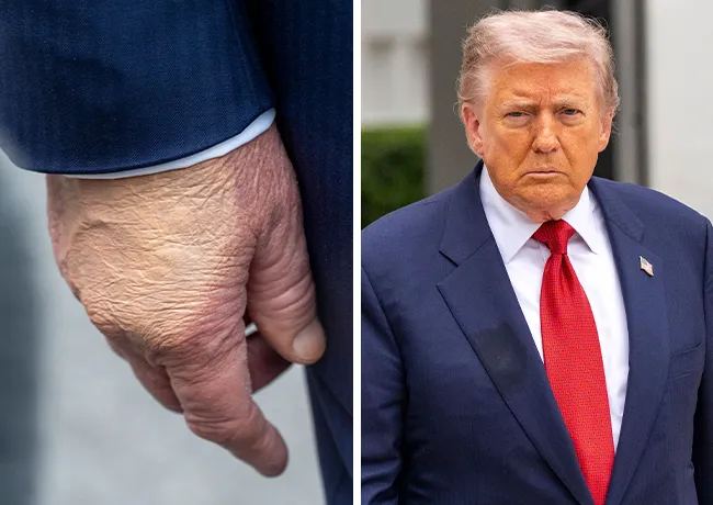 Donald Trump close up of hand