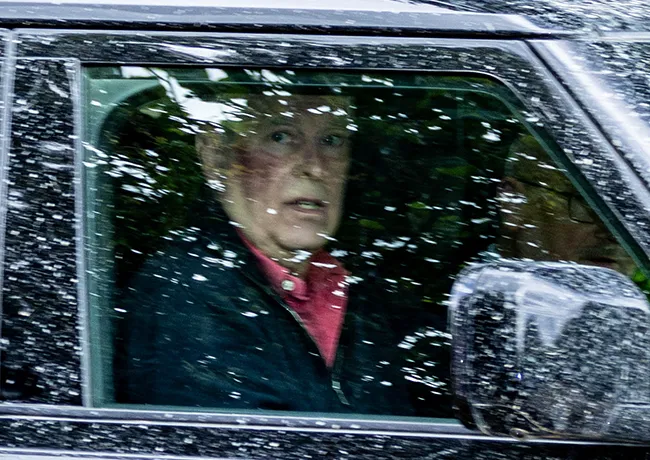 "Andrew Mountbatten-Windsor with a bruise on his right cheek"